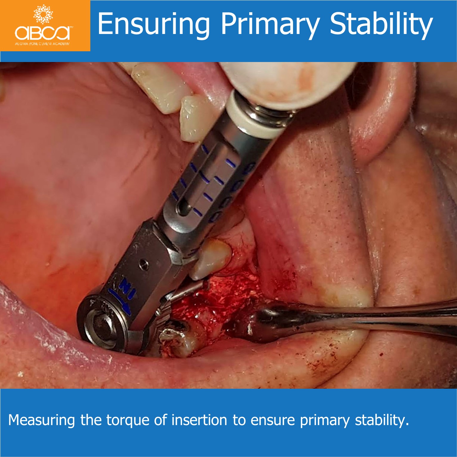 Clinical Case